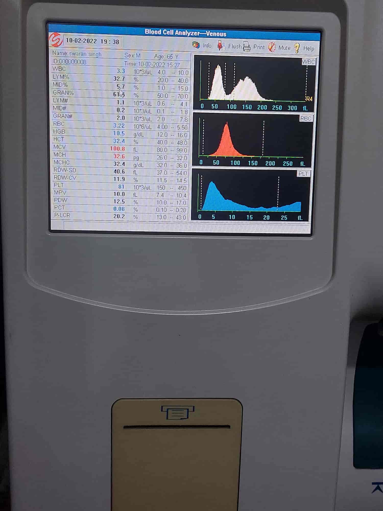 Lab view 3