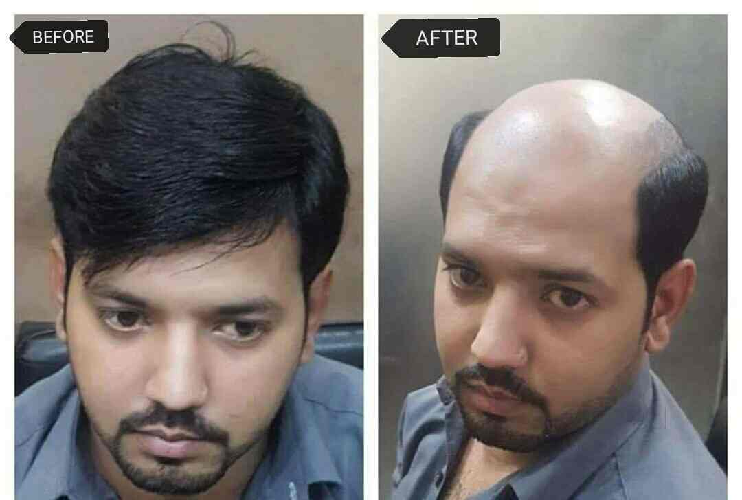 Abhishek Hair Weaving Center Ramnagar Wig Dealers In Anantapur