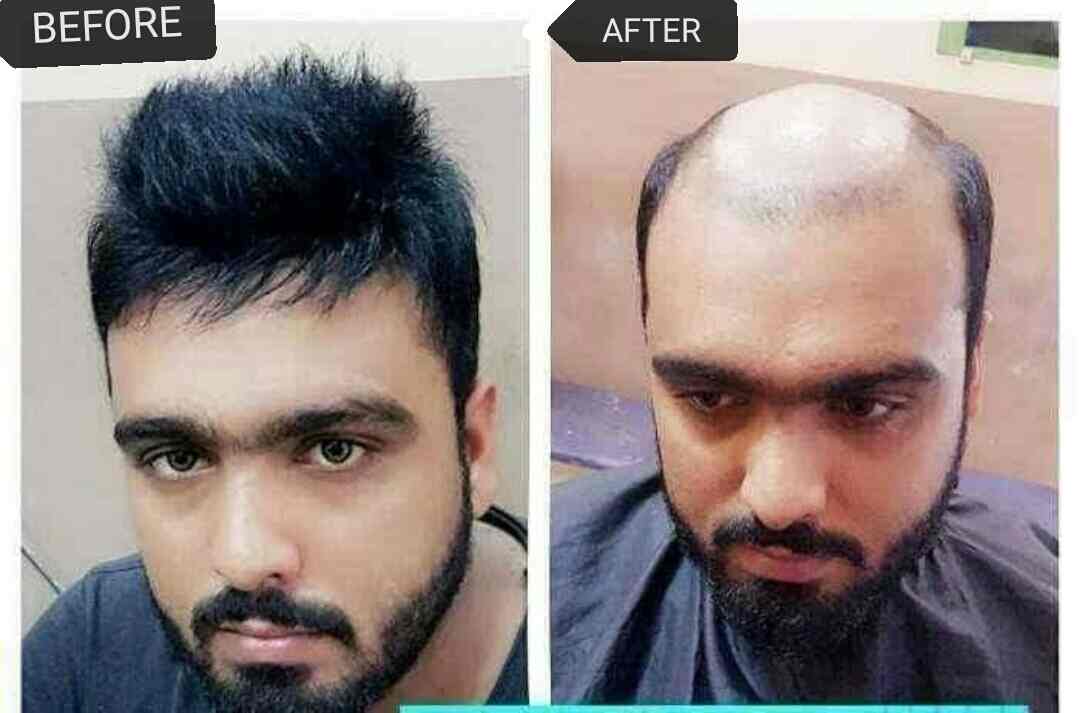 Abhishek Hair Weaving Center Ramnagar Wig Dealers In Anantapur