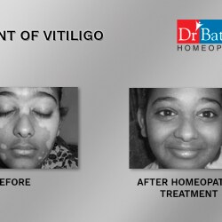 dr batra skin clinic near me