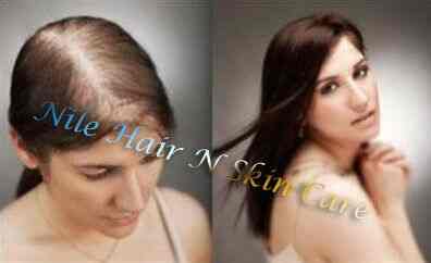Nile Hair N Skin Care Hair Bonding Hair Weaving Center Hair Fixing