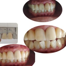 All Care Dental Centre Dentists Book Appointment Online Dentists In Indiranagar Bangalore Justdial