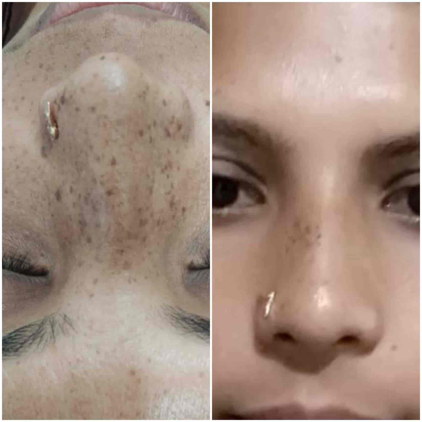 laser care clinic bilaspur