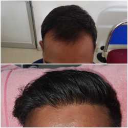 laser care clinic bilaspur