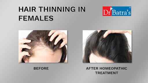 dr batra skin clinic near me