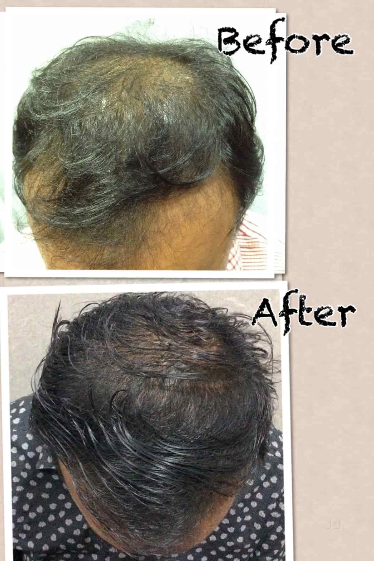 aarthi skin care mrc nagar