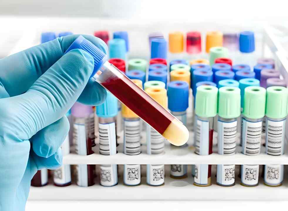 Troy Life Sciences Yelahanka New Town Laboratory Testing Services In Bangalore Justdial