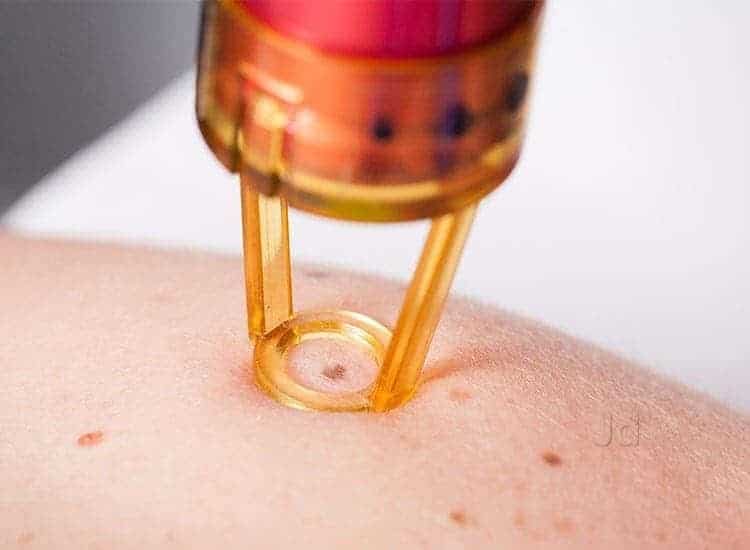 savitha skin care clinic