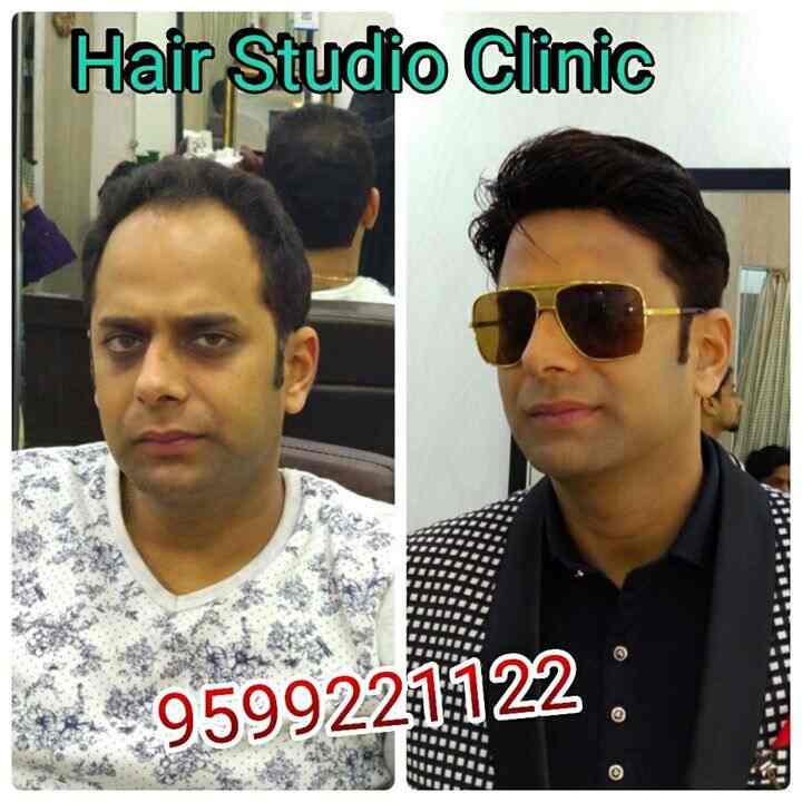 Hair Studio Clinic Hair Transplant Clinics Book Appointment
