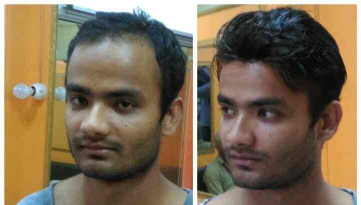 Hair Studio Clinic Hair Transplant Clinics Book Appointment