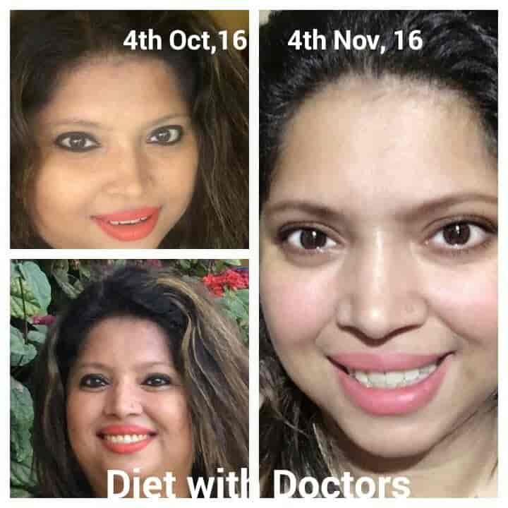 Slimlite garcinia cambogia complex review image 1