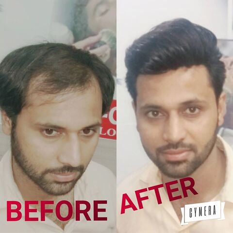 Rizy Hair Solution Chawri Bazar Wig Dealers In Delhi Justdial