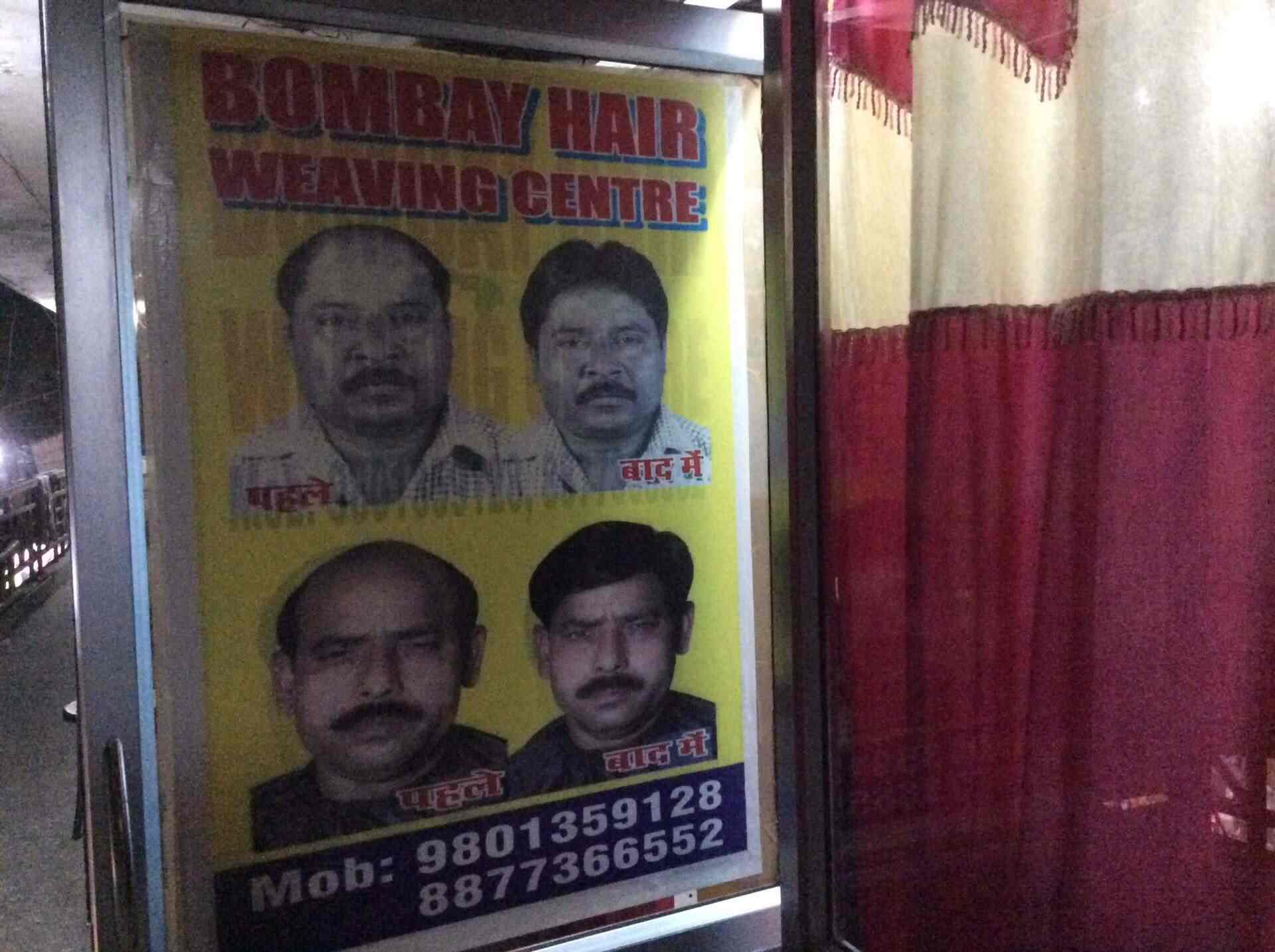 Bombay Hair Weaving Clinic Dhanbad Hirapur Hair Transplant