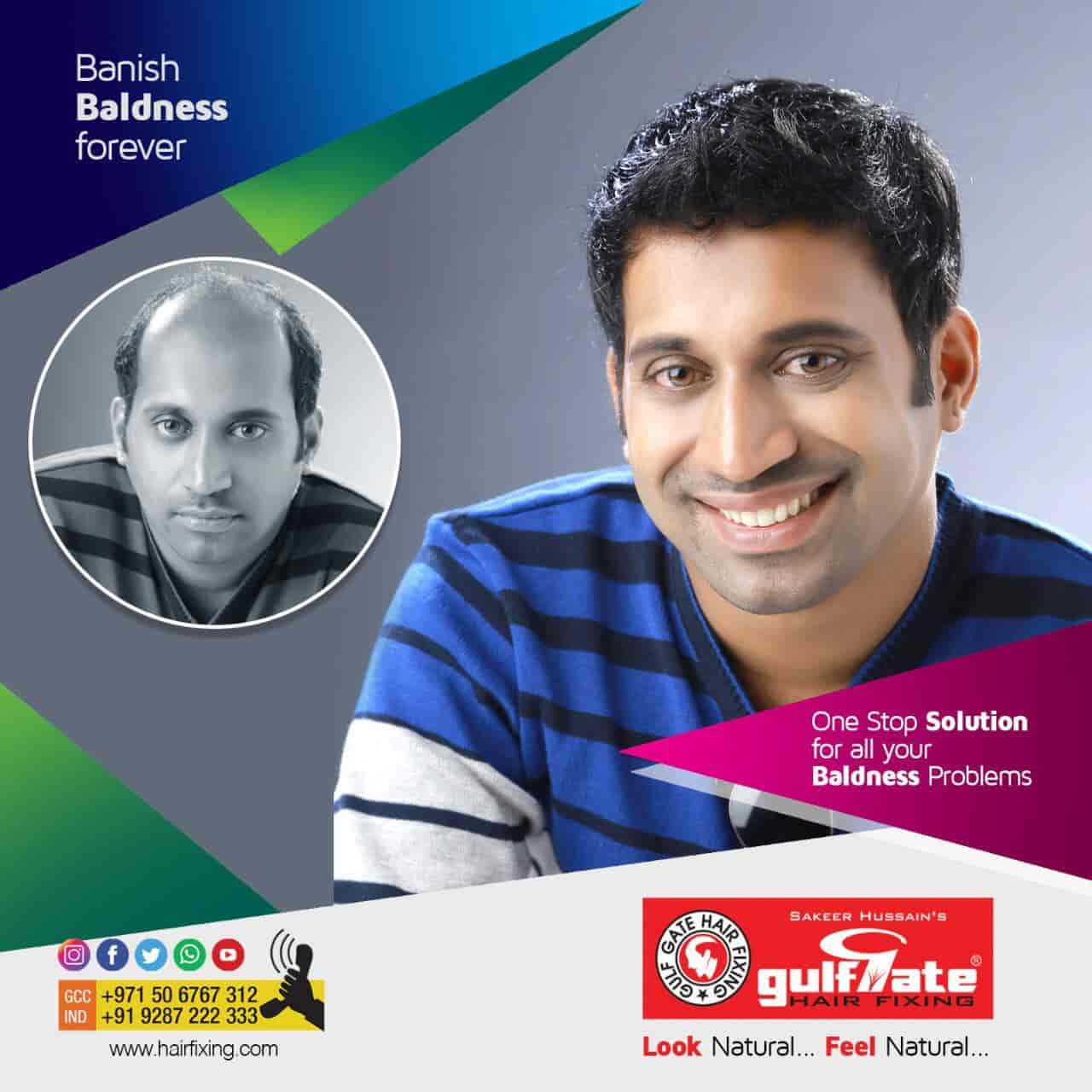 Top more than 62 hair fixing in ernakulam latest in.eteachers