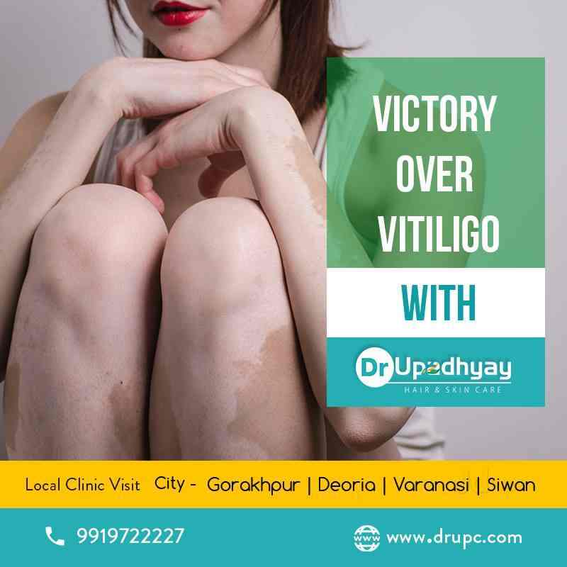 dr upadhyay hair and skin care