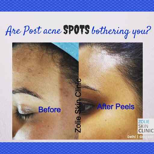 zolie skin clinic near me
