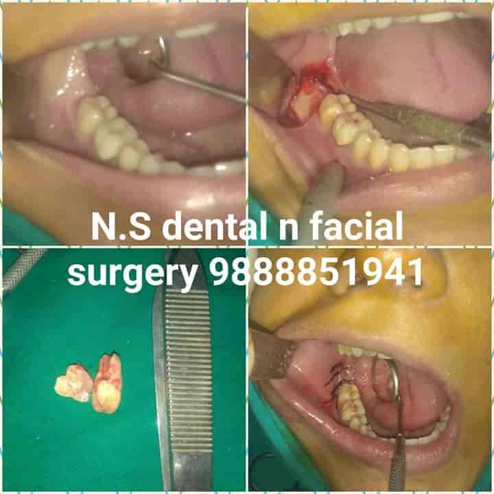 N S Dental Facial Surgery Centre Dentists Book Appointment Online Dentists In Kamalpur Hoshiarpur Justdial