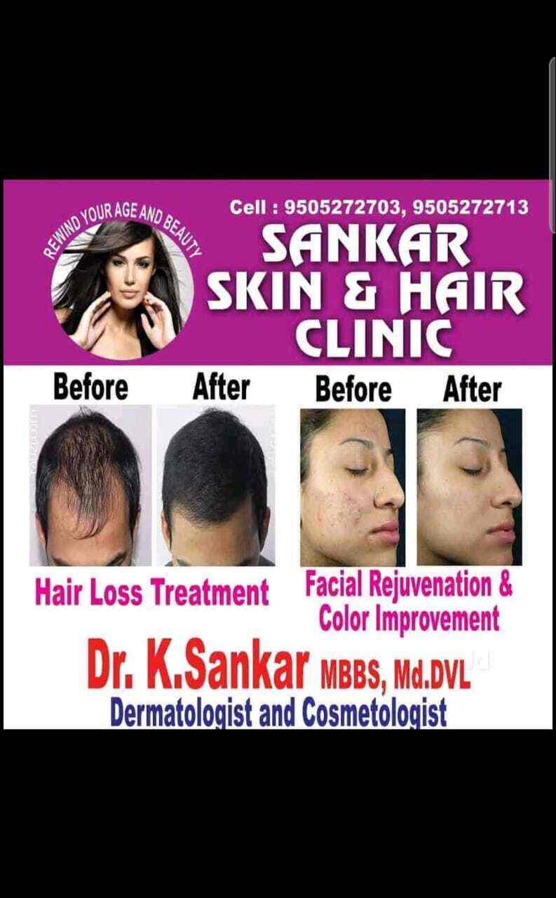 Details 142+ sankar skin and hair clinic latest camera.edu.vn