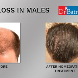 Dr Batra S Healthcare Dermatologists Book Appointment Online Dermatologists In Hitech City Hyderabad Justdial