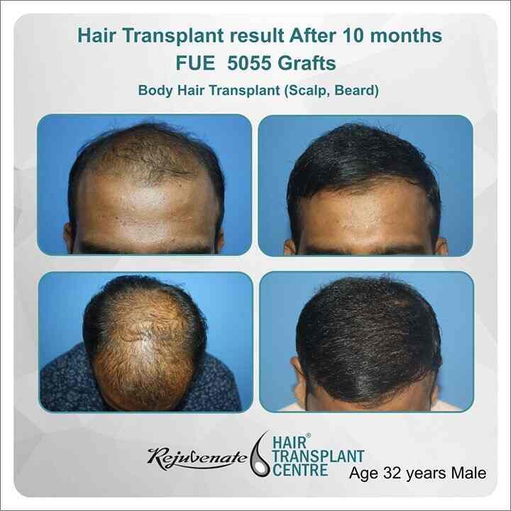Rejuvenate Hair Transplant Cosmetic Surgery Centre