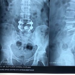 Indore Spine Centre Spine Specialist Doctors Book Appointment Online Spine Specialist Doctors In Anoop Nagar Indore Justdial Amiya prasad, md is a ophthalmic plastic & reconstructive surgery specialist in garden city, ny and has over 32 years of experience in the medical field.