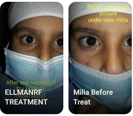 advanced skin care and laser