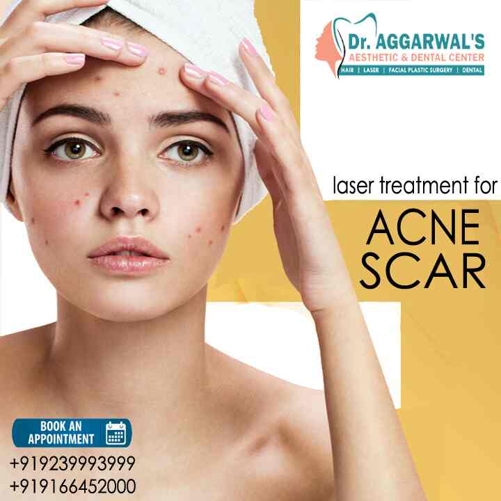 Top more than 145 hair transplant in jodhpur best camera.edu.vn