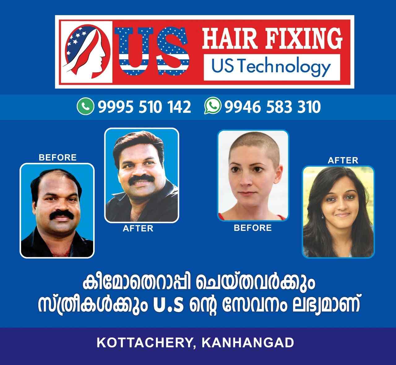 Discover 108+ hair fixing thrissur super hot dedaotaonec
