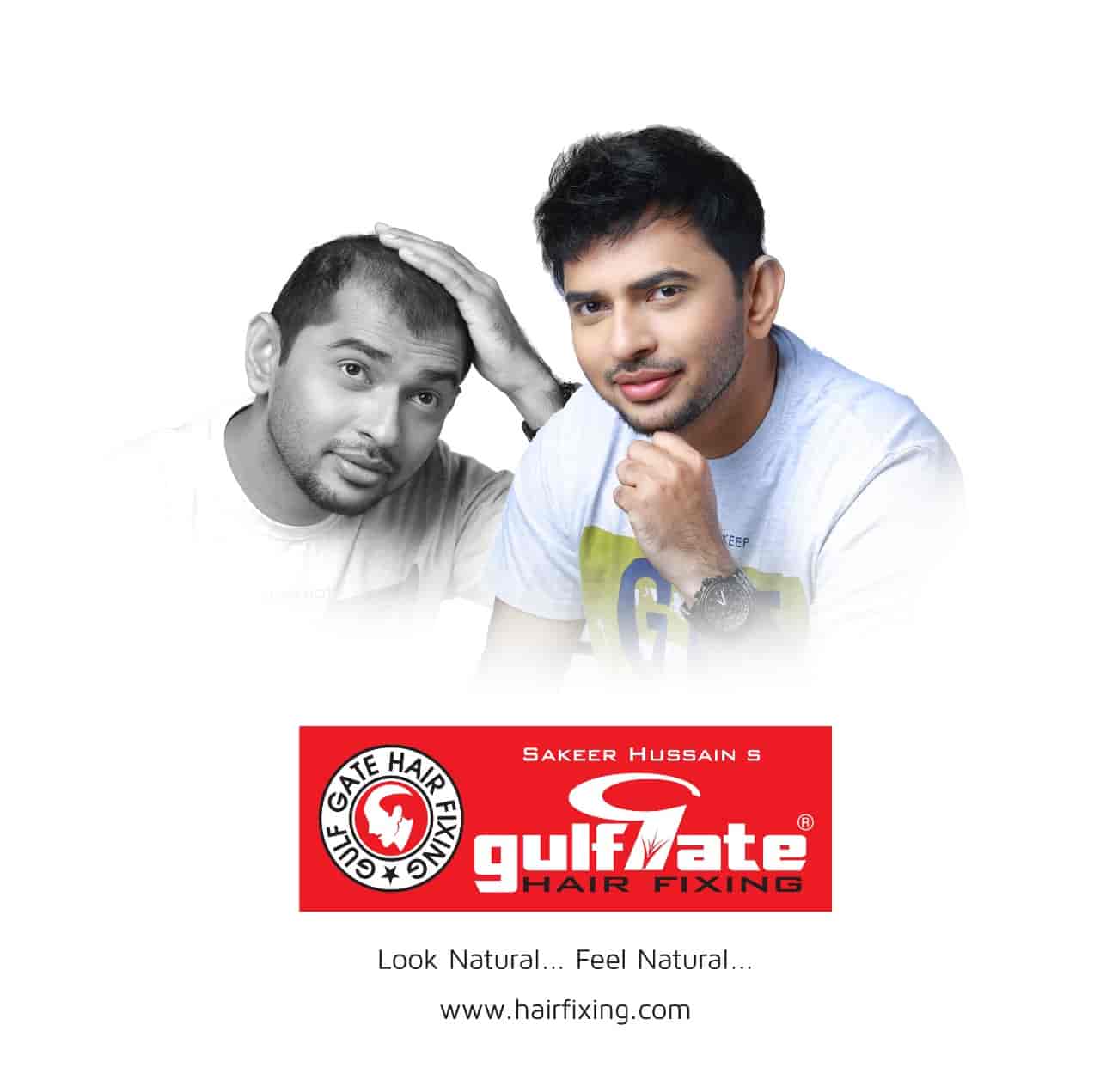 Gulf Gate Hair Fixing in Mavoor Road,Kozhikode - Best Hair Transplant  Doctors near me in Kozhikode - Justdial