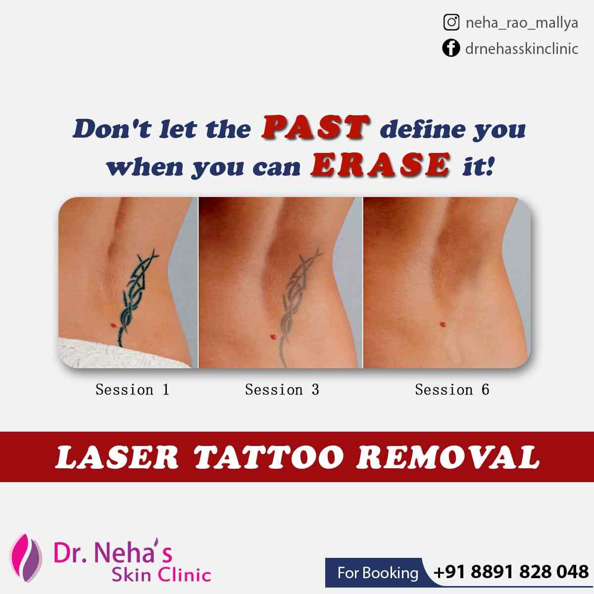 neha skin clinic