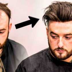 Fair And Hair Madurai Bazaar Hair Rebonding Services In Madurai
