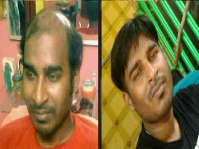 Natural Hair Fixing Center Photos Falnir Mangalore Pictures