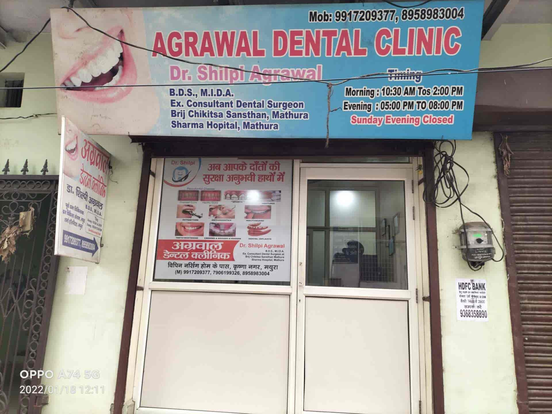 Are You Actually Doing Enough cost of smile transformation?