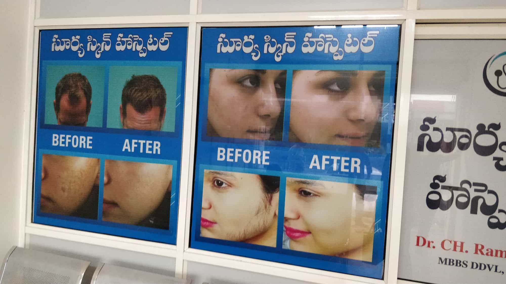 Discover more than 134 surya skin & hair hospital tnbvietnam.edu.vn