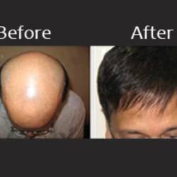 New Look Hair Weaving Center Andheri West Wig Dealers In Mumbai