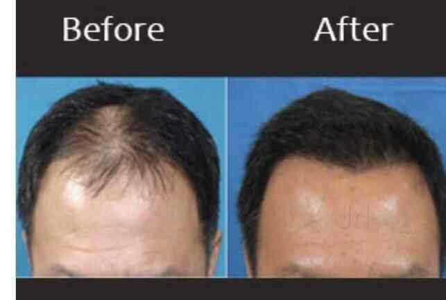 New Look Hair Weaving Center Andheri West Wig Dealers In Mumbai