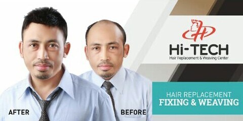 Hi Tech Hair Weaving Centre Kalyan West Wig Dealers In Thane