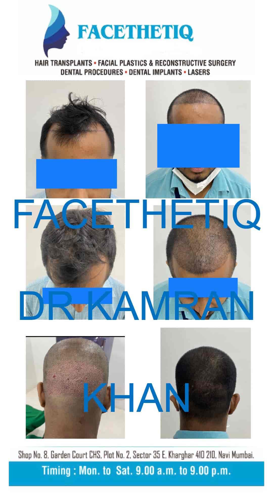 Aggregate 163+ hair transplant cost navi mumbai best tnbvietnam.edu.vn