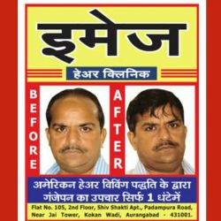 Image Hair Clinic Hair Transplant Clinics Book Appointment