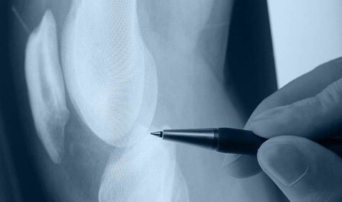 Dr Darius F Soonawala Soonawala Orthopaedic Urology Clinic Orthopaedic Doctors Book Appointment Online Orthopaedic Doctors In Kemps Corner Mumbai Justdial Enemies struck by the blade take more damage than those struck by the handle.