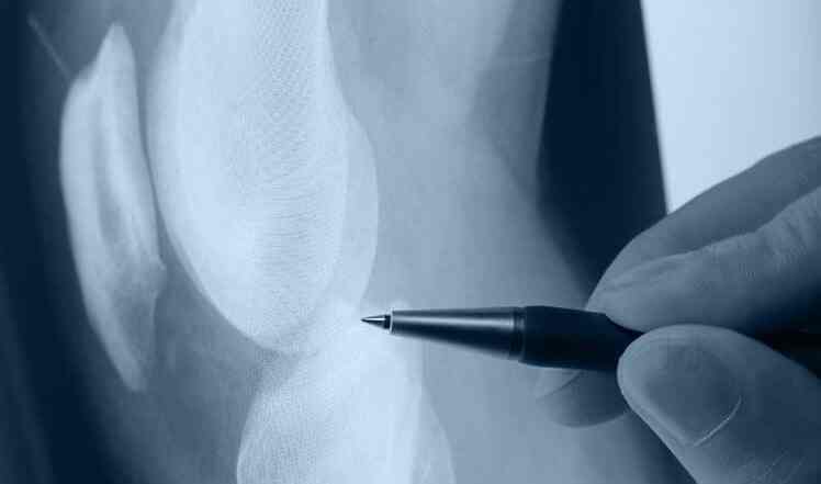 Dr Darius F Soonawala Soonawala Orthopaedic Urology Clinic Orthopaedic Doctors Book Appointment Online Orthopaedic Doctors In Kemps Corner Mumbai Justdial 421 visiting obst & gynecologist.