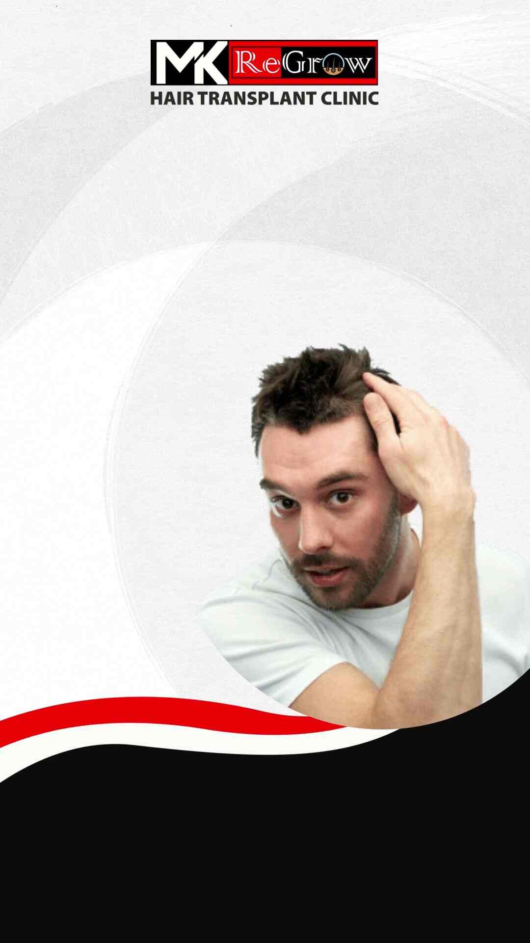 Discover 66+ best hair transplant in nagpur best in.eteachers
