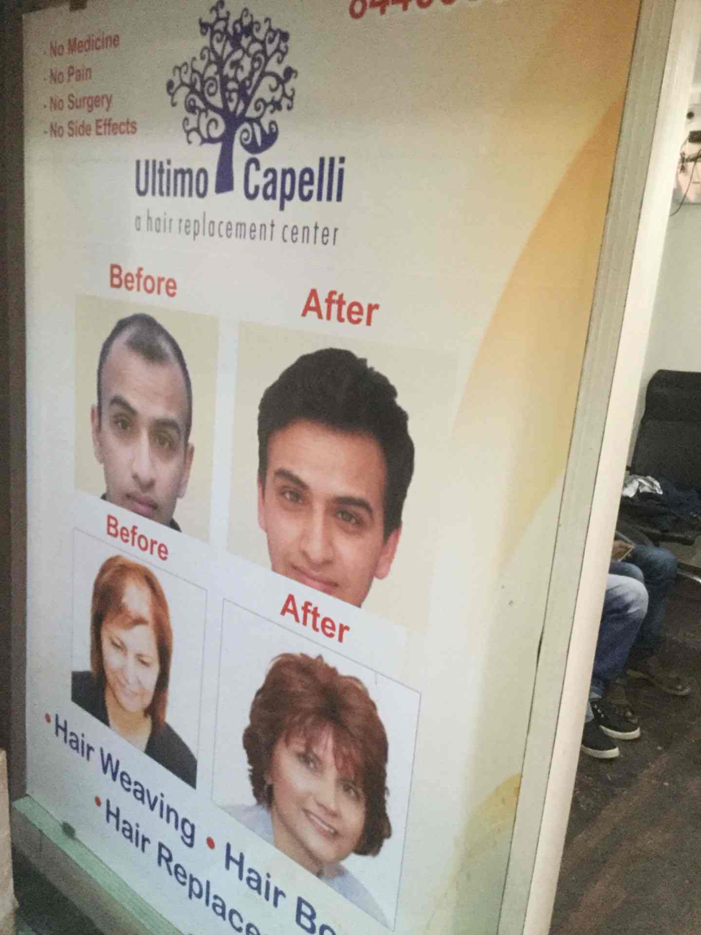 Ultimo Capelli A Hair Replacement Clinic Photos Nashik Road