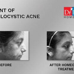 batra skin clinic near me