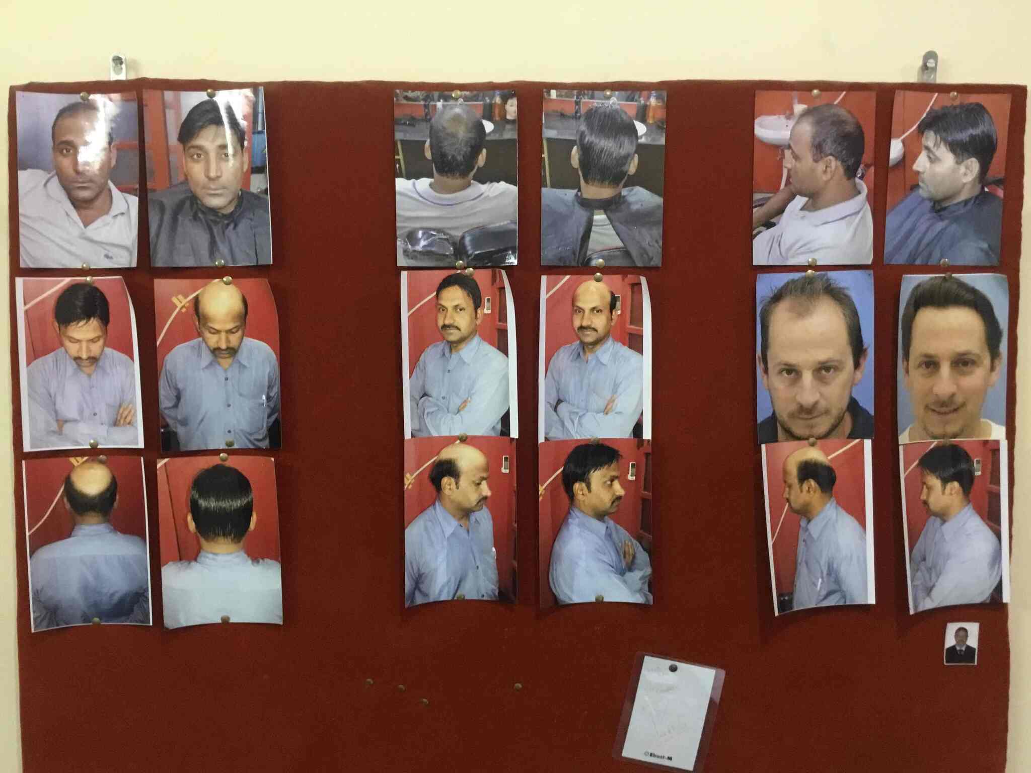 Gudlook Hair Weaving Centre Photos Leela Bhawan Patiala