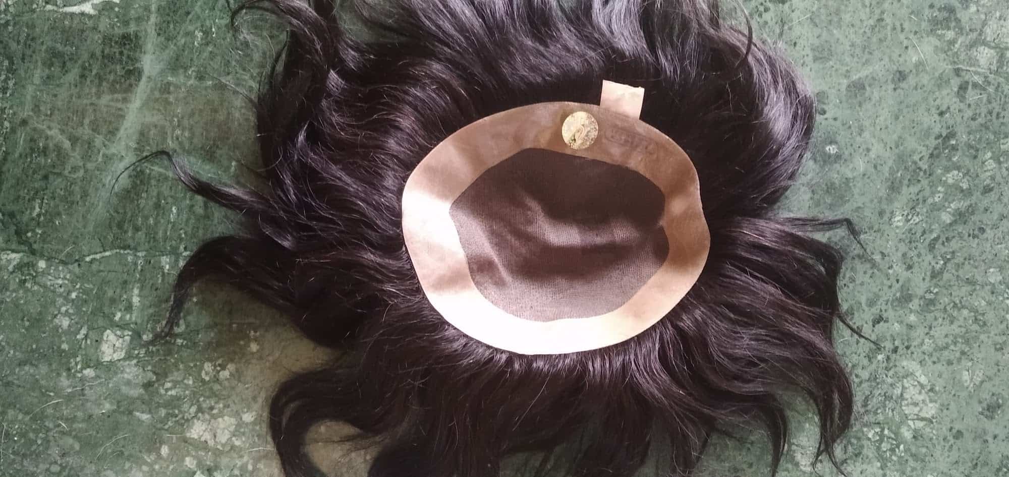 Details 150+ hair patch in siliguri camera.edu.vn