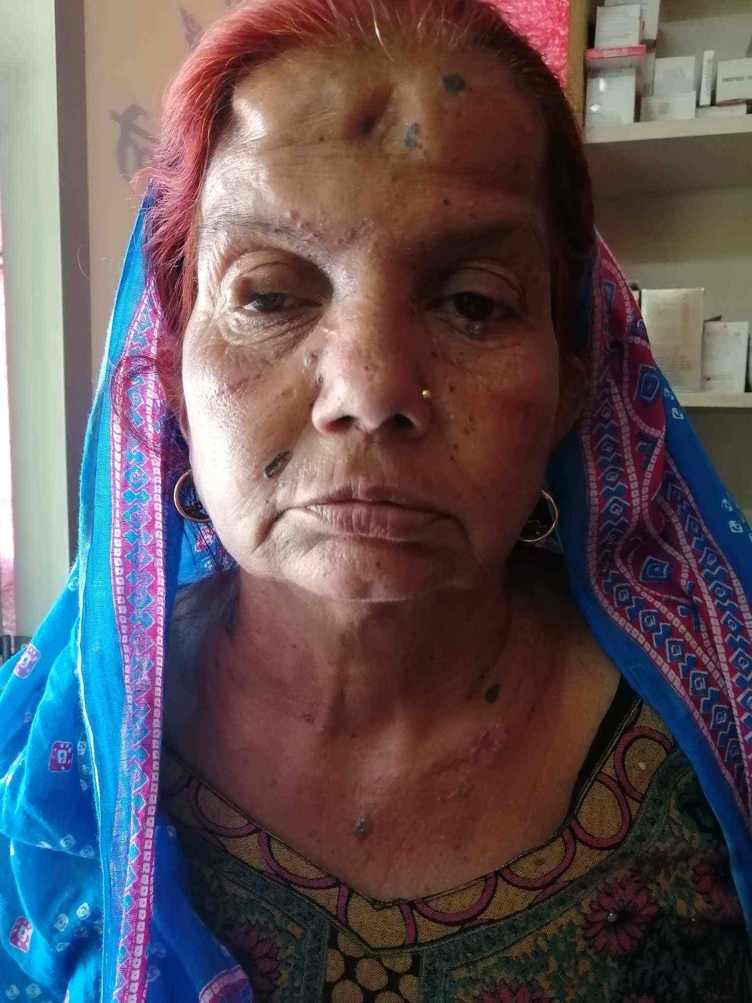 Dharmarth Skin Care Clinic Dermatologists Book Appointment Online Dermatologists In Adarsh Nagar Sonepat Justdial