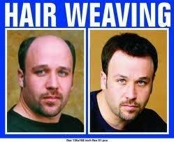 Natural Hair Replacement Centre Hair Loss Doctors Book