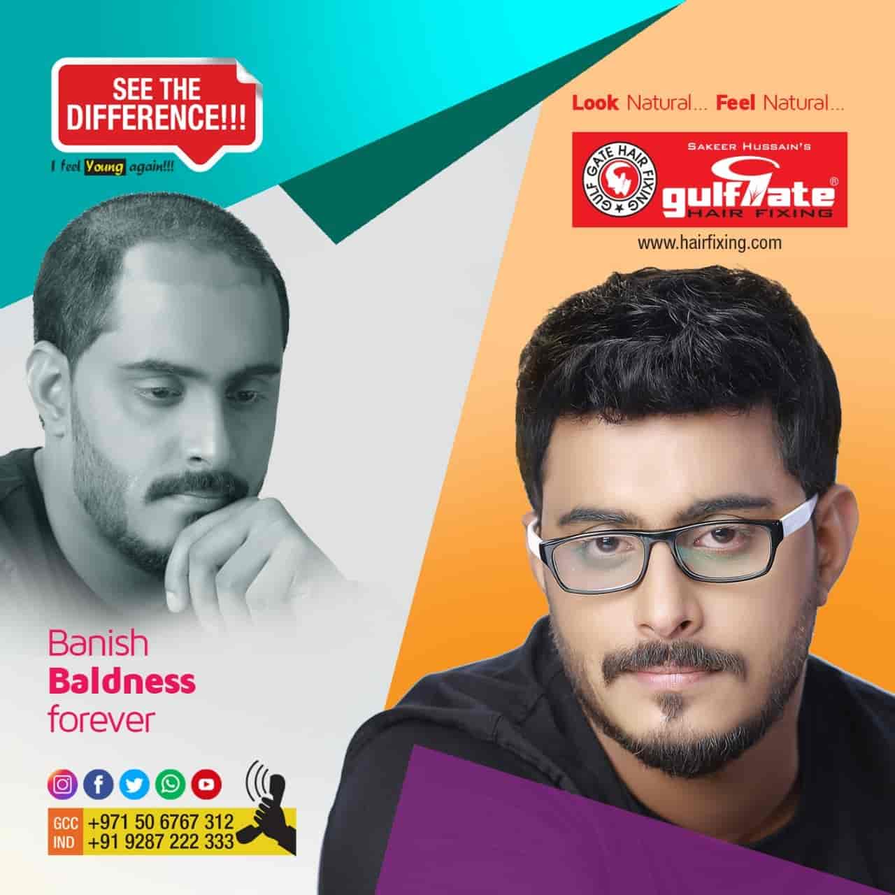 Details more than 120 hair fixing thrissur super hot POPPY