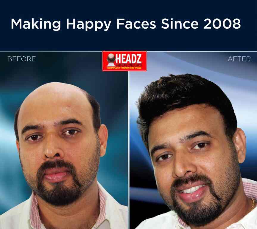 Top 126+ hair fixing thrissur latest tnbvietnam.edu.vn